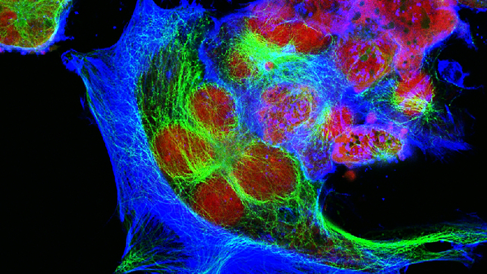 New Research Shows the Deadly Effect of Neurons on Cancerous Tumors